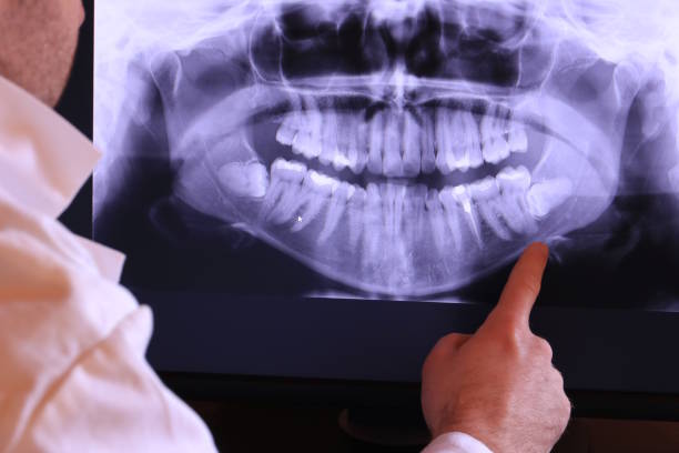 Best Emergency Tooth Extraction in Midway, AR