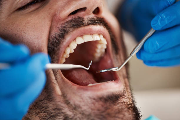 Best Emergency Dental Care for Broken or Chipped Teeth in Midway, AR