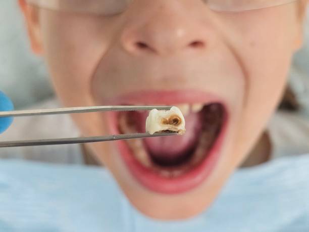 Best Emergency Dental Care for Broken or Chipped Teeth in Midway, AR